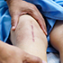 INFORMACJE DERMATOLOGICZNE!