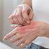 INFORMACJE DERMATOLOGICZNE!